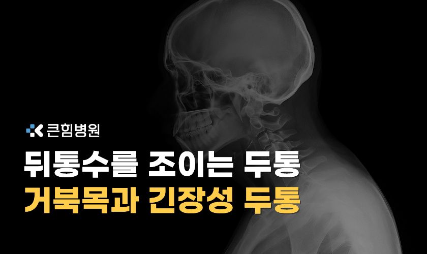 부산거북목치료 두통과 교정 방법
