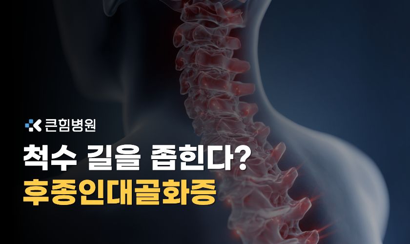 부산경추병원 후종인대골화증이 뭔가요?