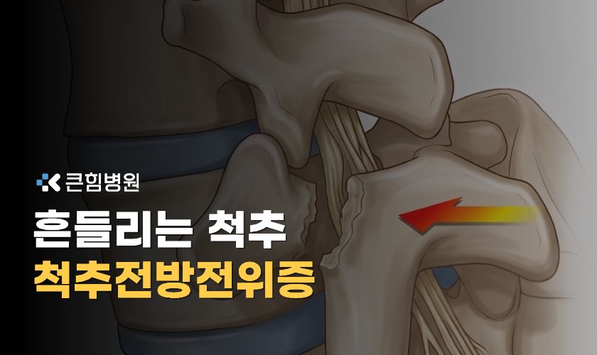 부산 척추전방전위증 치료와 등급 기준