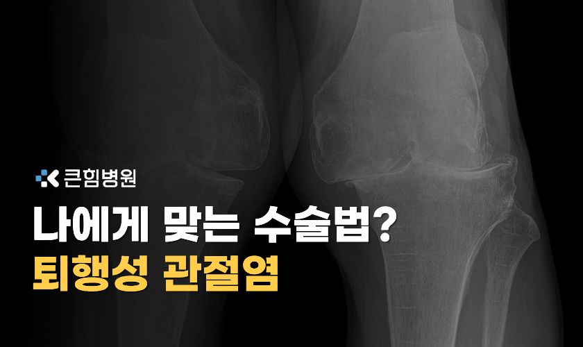 부산 퇴행성 관절염 치료, 절골술 vs 인공관절