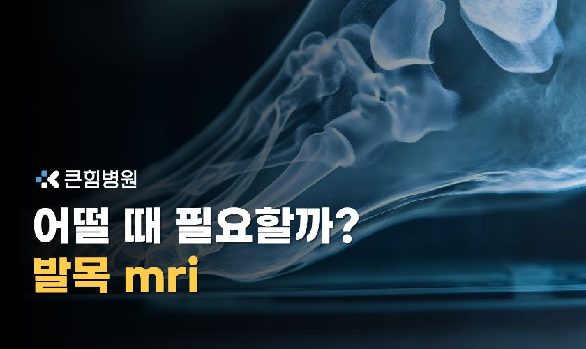 부산발목mri 꼭 찍어야 하는 경우