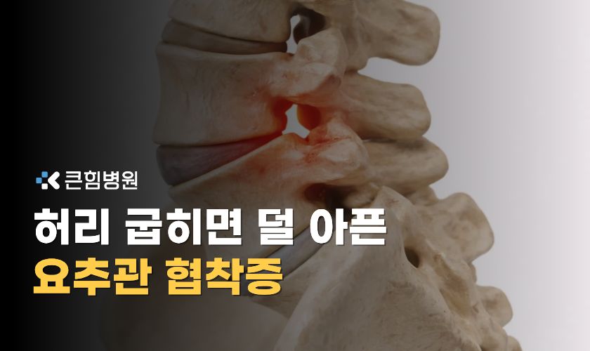 요추관협착증 증상과 치료 그리고 허리디스크와의 차이?