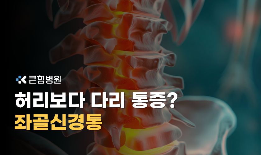 부산 척추 병원 추천 전 좌골신경통 원인부터 