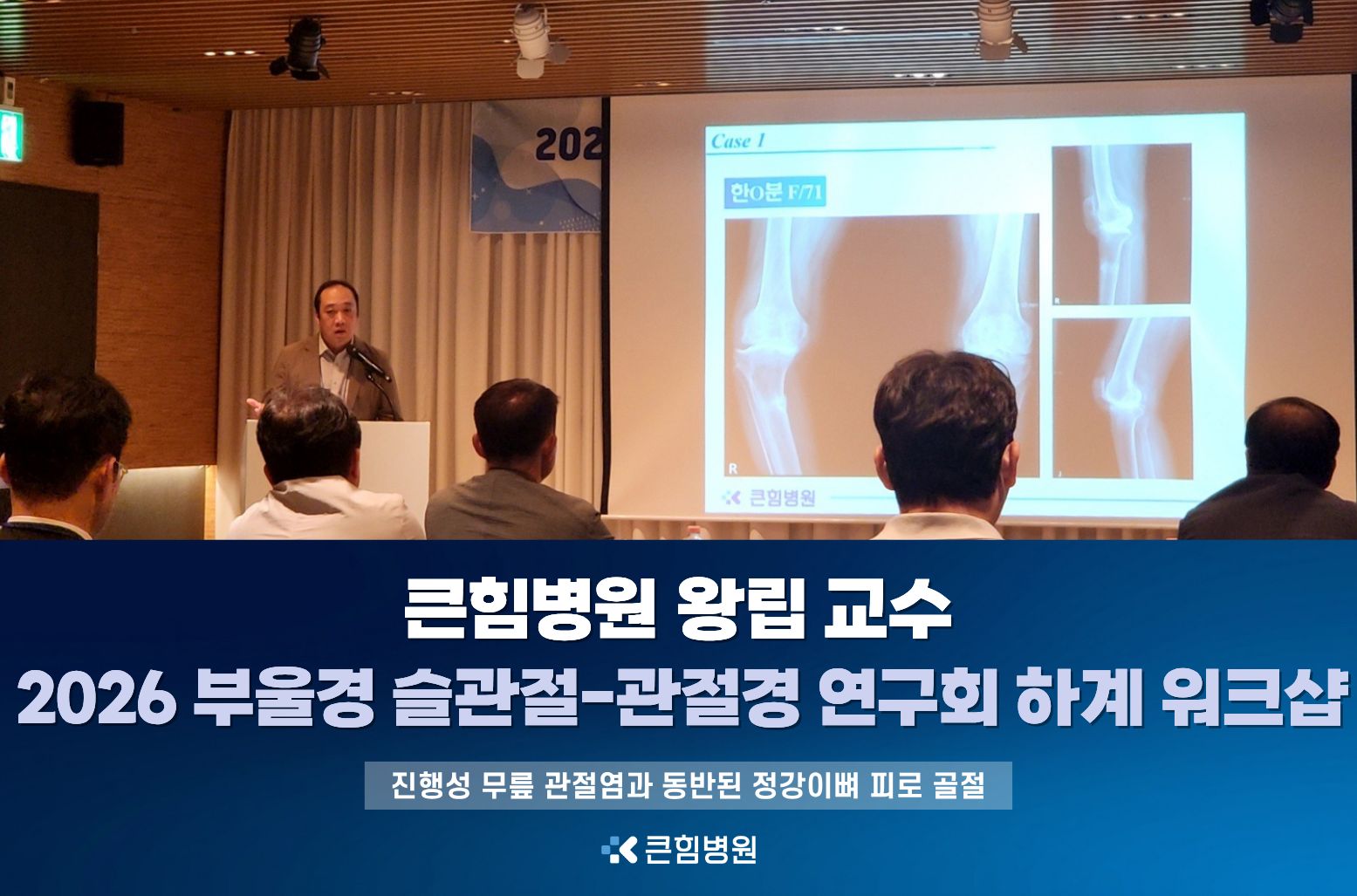 [큰힘병원] 왕립 교수, 2026 부울경 슬관절-관절경 연구회 하계 워크샵 발표